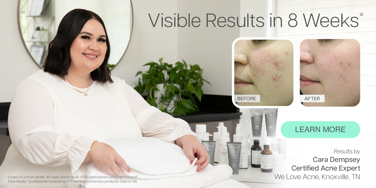Master Your Clear Skin Journey